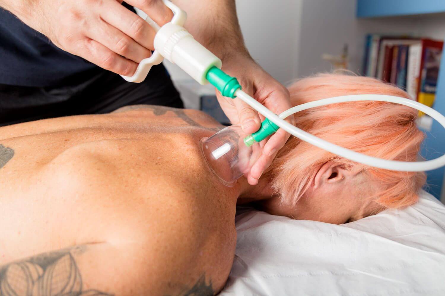 Euphoria Sports Therapy cupping therapy treatment