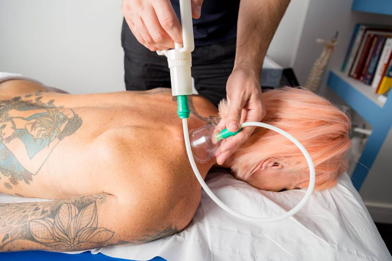 Cupping therapy cups applied during treatment