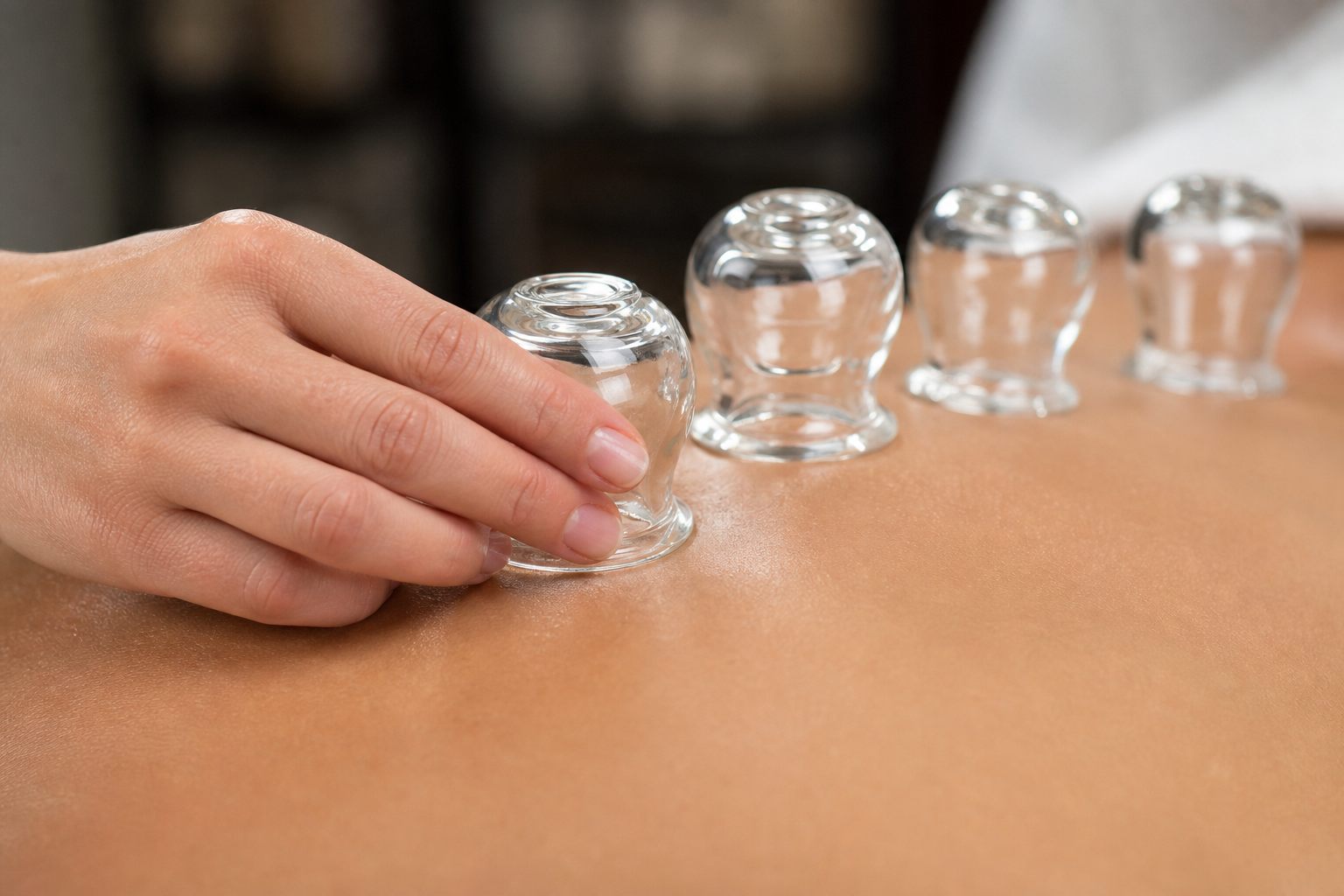 Cupping Therapy