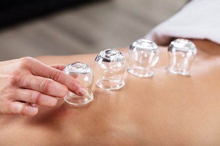 euphoria sports therapy cupping therapy