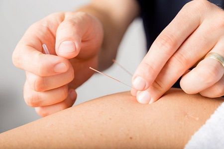 euphoria sports therapy sports injury acupuncture